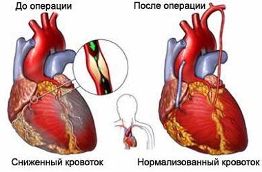 АКШ в Израиле